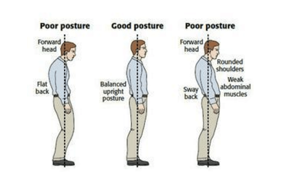Bildkälla: http://www.thephysiocompany.com/blog/stop-slouching-postural-dysfunction-symptoms-causes-and-behandeling-of-bad-posture