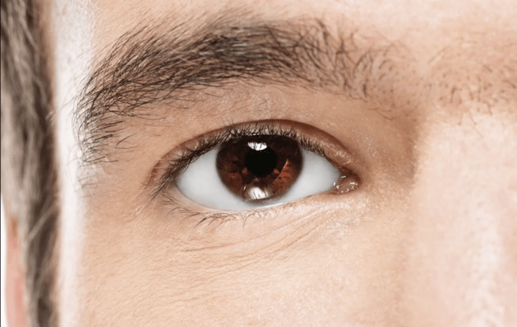 akut vinkelförslutnings glaukom