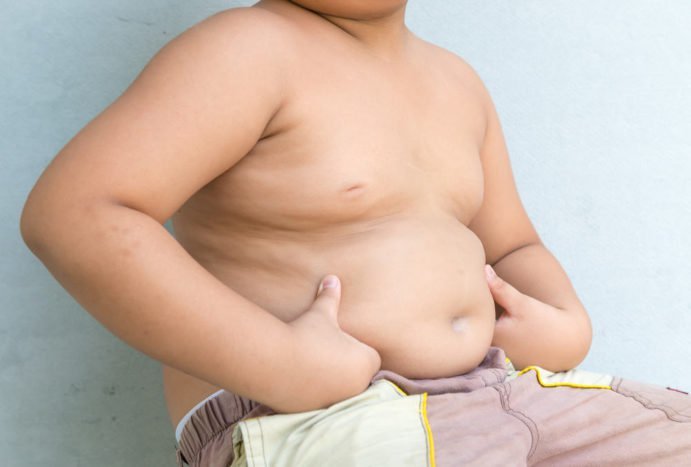 fetma hos barn