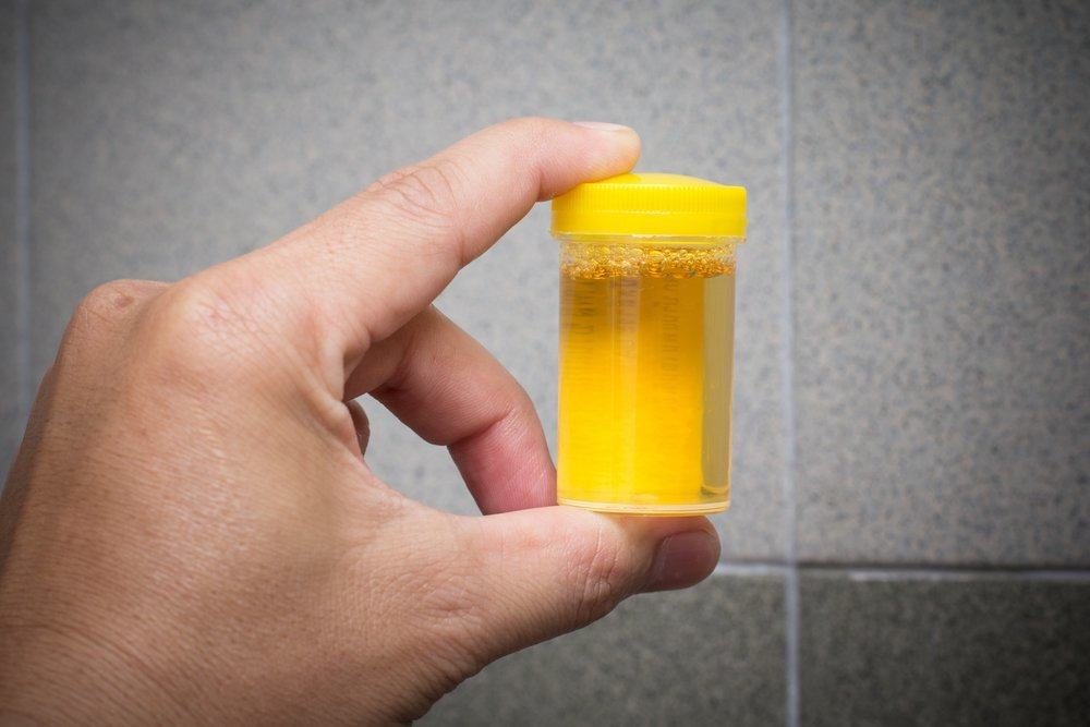 urinbehandling för att dricka urin