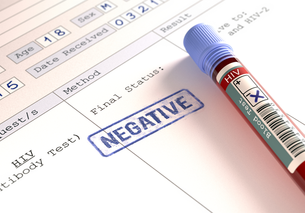 meningen med resultaten av ett negativt HIV-test