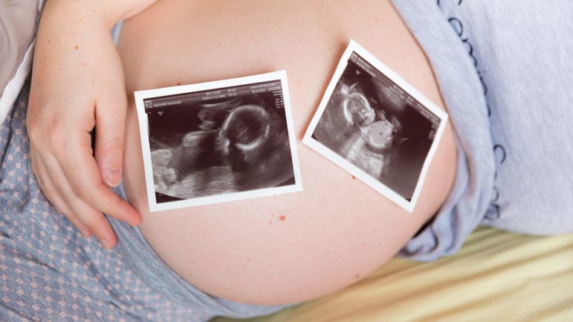risken att bli gravid med tvillingar försvinner