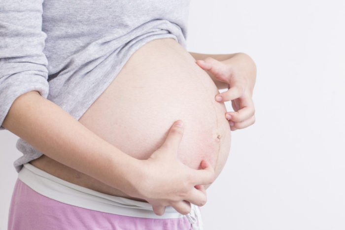 Pruritic folliculitis är orsaken till kliande hud under graviditeten