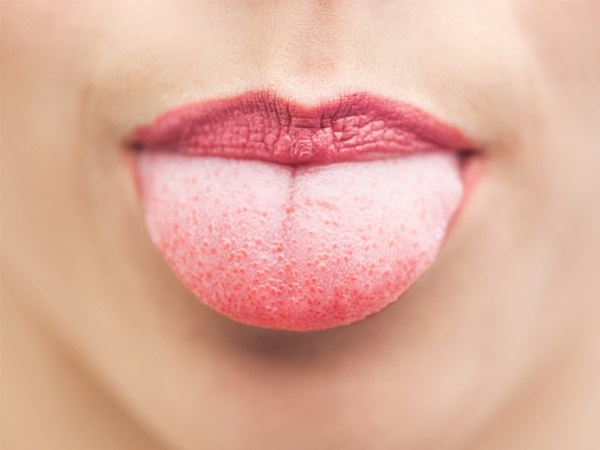 tungens färg betyder sjukdom